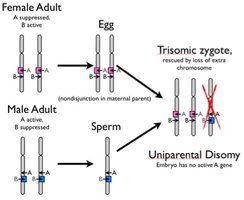 Clinical images of Prader-Willi and Angelman syndromes