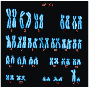 Human male karyotype