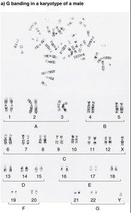 G-banding in a karyotype of a male