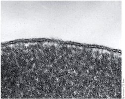 Electron micrograph of cell membrane