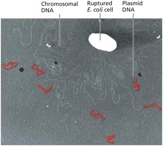 Electron micrograph of E. coli DNA showing chromosomal and plasmid DNA