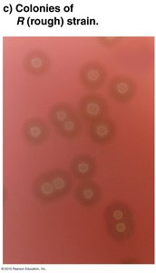 Colonies of R (rough) strain