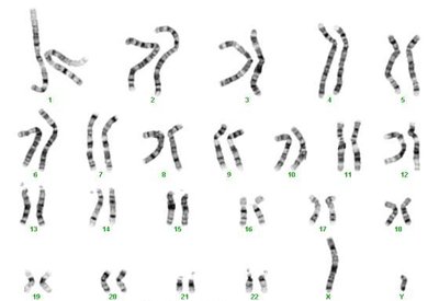 Karyotype 46,XX