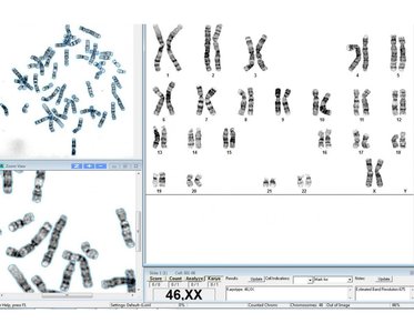 G-banded karyotype