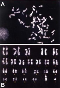 Q-banded karyotype