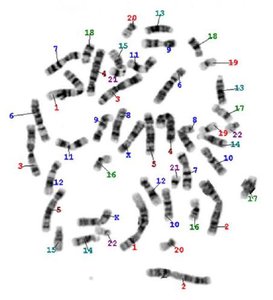 Human karyotype with numbered chromosomes