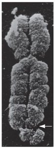 Fragile X chromosome