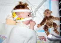 Infant with SMA