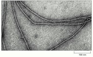 A three-dimensional reconstruction from serial sections