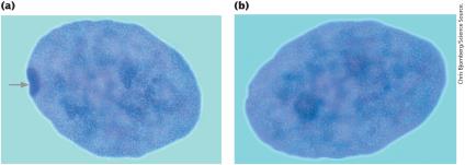 Barr body in female cell nucleus