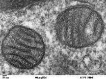 Mitochondria under electron microscope