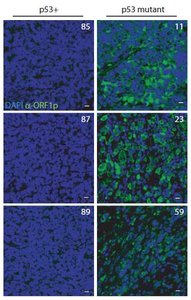 p53 mutant vs wild type expression