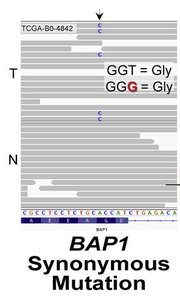 BAP1 mutation, exon skipping, and patient prognosis