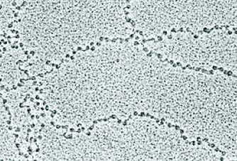 Electron micrograph of beads-on-string structure of chromatin (nucleosomes)