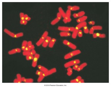 FISH image showing labeled chromosomes