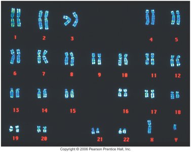 Human karyotype showing diploid chromosome pairs
