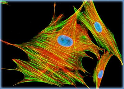 Fluorescent micrograph of cytoskeleton in eukaryotic cells