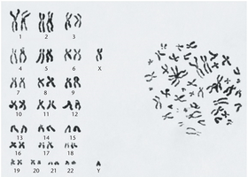 Human karyotype