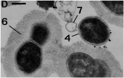 Electron micrograph of Streptococcus pneumoniae