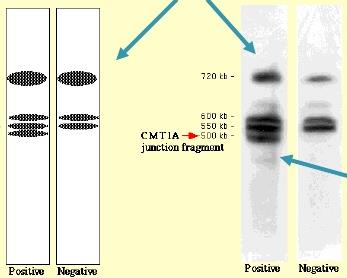 Gel electrophoresis showing duplication