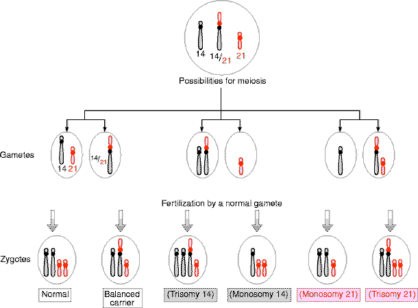 Robertsonian translocation consequences