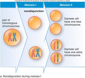 Karyotype showing mosaicism