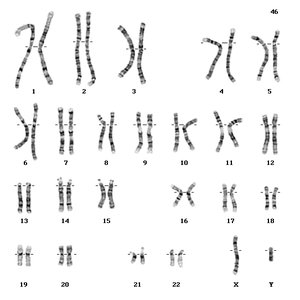 Human karyotype (46; XY)