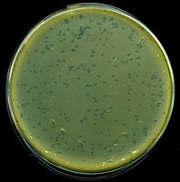 Plaques on bacterial lawn
