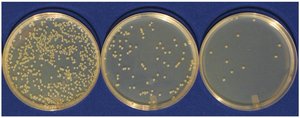Serial dilution plates showing decreasing colony numbers
