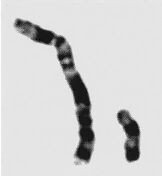 Photograph of X and Y chromosomes