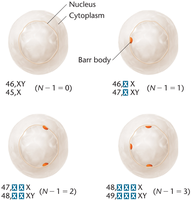 Diagram showing Barr bodies in cells with different X chromosome compositions