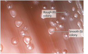Smooth and rough colonies of Pneumococcus