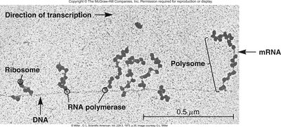 Electron micrograph showing transcription-translation coupling and polysomes