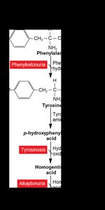 Metabolic pathway of phenylalanine with genetic disorders highlighted