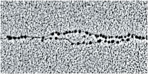 Electron micrograph showing DNA complexed with histone proteins