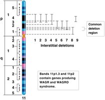 Interstitial deletions in chromosome 11