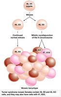 Chromosome mosaicism in Turner syndrome