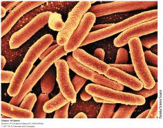 Comparison of inducible and repressible operons