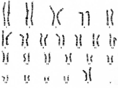 Human karyotype