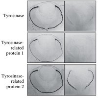 Gene expression of tyrosinase and related proteins in wild-type and MITF mutant embryos