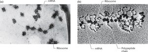 Electron micrograph of polyribosomes on mRNA