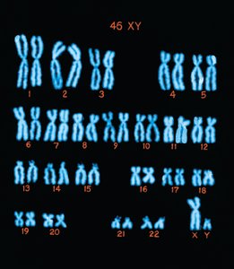 Colorized image of the human male chromosome set (karyotype)