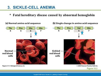 Sickle cell anemia: normal vs sickled red blood cells