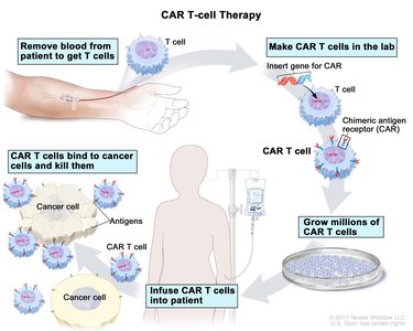 CAR T-cell therapy process