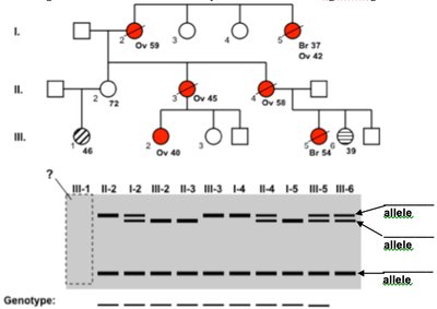 BRCA-1 pedigree and gel analysis