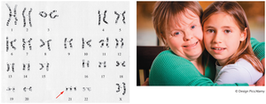 Karyotype and individuals with Down syndrome
