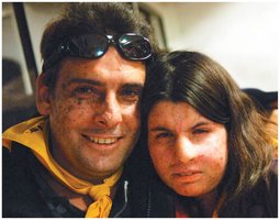 XP patient with skin abnormalities