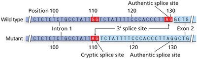 Cryptic splice site creation in β-globin gene