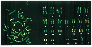 Human XY karyotype