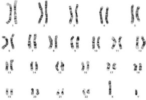 Human karyotype (black and white)